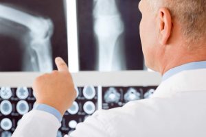 doctor and xrays for weak bones